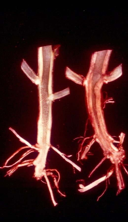 Potato stems cut open, showing discolored streaks inside from Verticillium wilt
